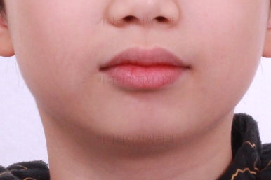 부산어린이교정