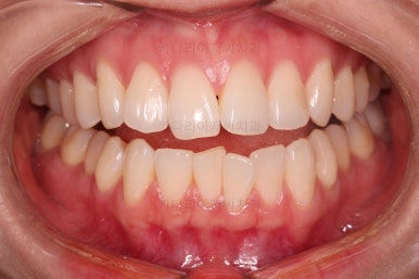 부산연산동부분교정