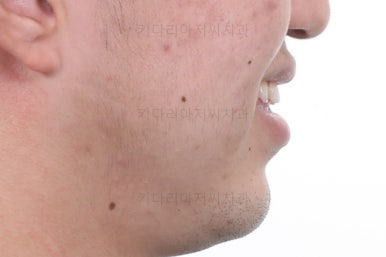 연산동교정전문치과