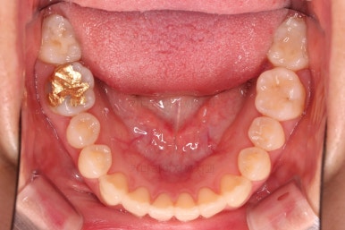 부산인비절라인