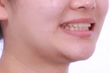 연산동교정치과