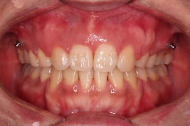 연산동교정치과