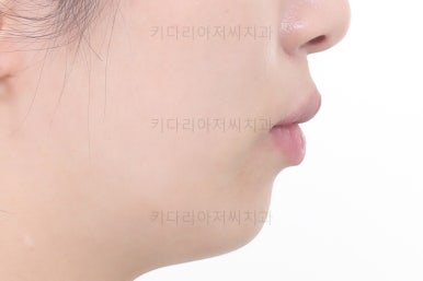 부산연산동부분교정