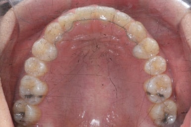 부산치아교정치과