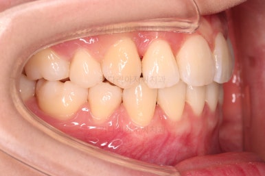 부산교정전문의