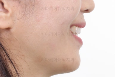 부산인비절라인