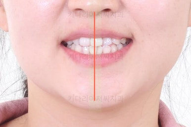 연산동교정치과