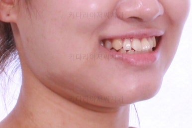 부산치아교정잘하는곳