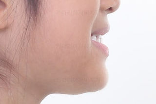 부산소아교정