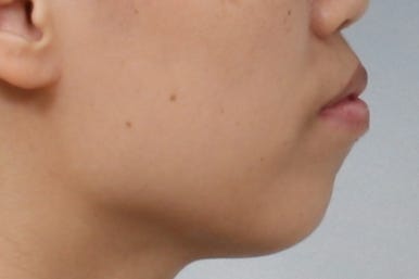 부산교정치과추천