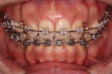 연산동교정치과