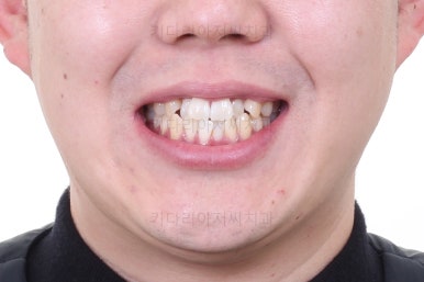 부산인비절라인