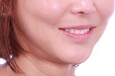 연산동부분교정