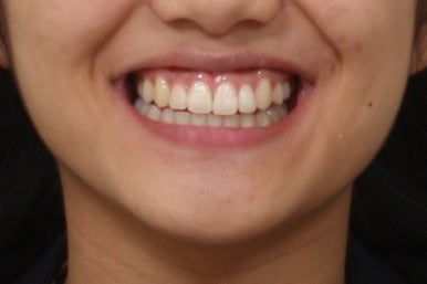 부산연산동청소년교정