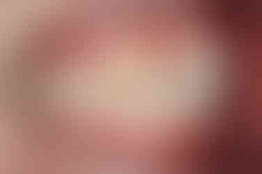 부산앞니부분교정