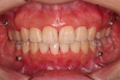 부산무턱교정치과