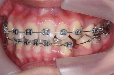 부산교정전문의