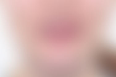 부산개방교합