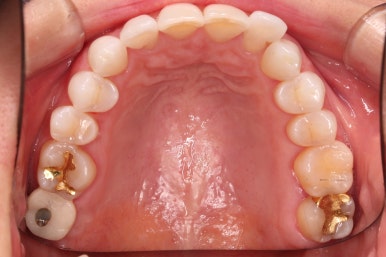 연산동부분교정