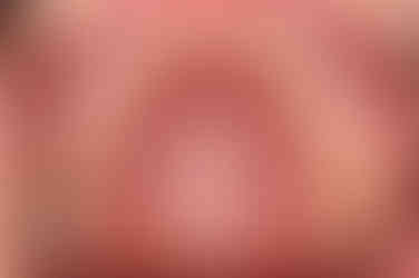 연산동부분교정