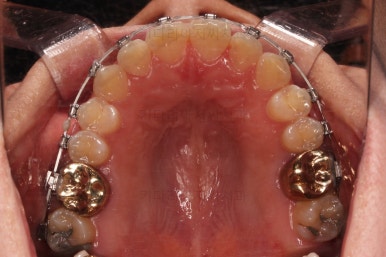 부산안면비대칭