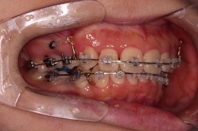 부산무턱교정치과
