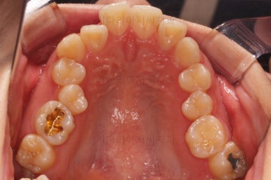 부산무턱교정치과