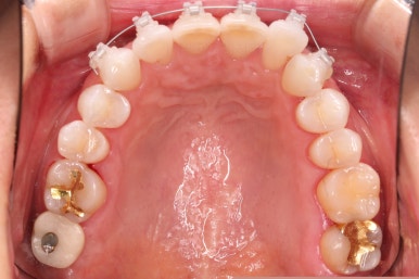 연산동부분교정