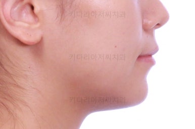 부산교정잘하는치과