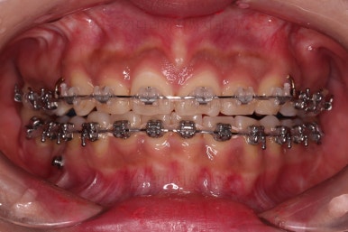 연산동교정치과