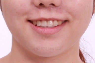 부산교정전문치과