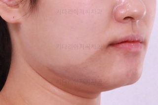부산치아교정잘하는곳