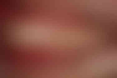 부산왜소치교정