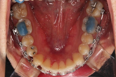 부산연제구교정