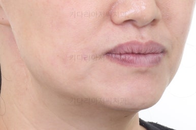 부산치아교정잘하는곳