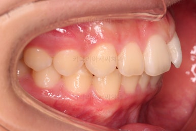 부산교정전문의