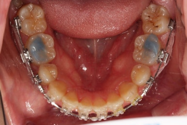 부산연산동교정치과