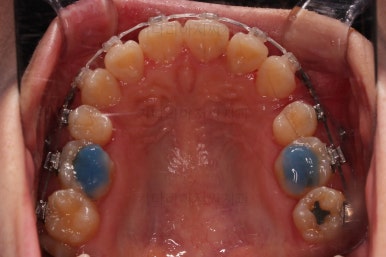 부산무턱교정치과