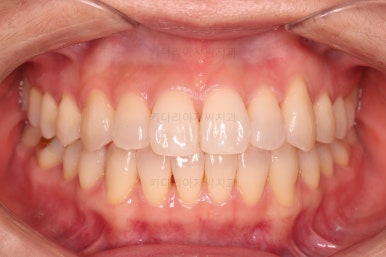 부산인비절라인