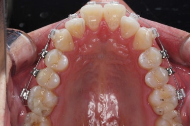 부산교정치과추천