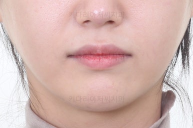 연산동교정치과