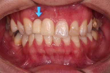 연산동치아교정
