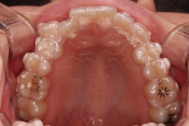 부산인비절라인