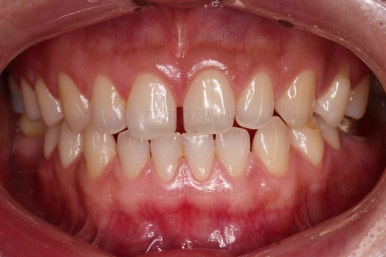 연산동임플란트