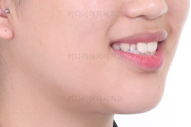 사직동교정치과