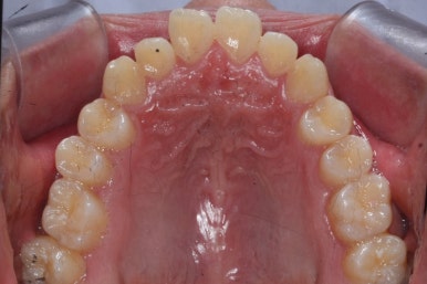 부산주걱턱교정