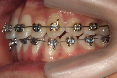 부산연산동청소년교정