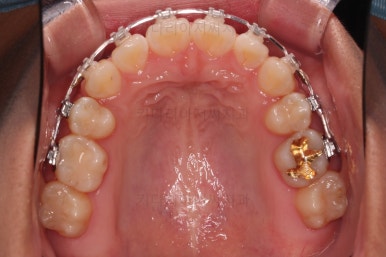 연산동치아교정치과