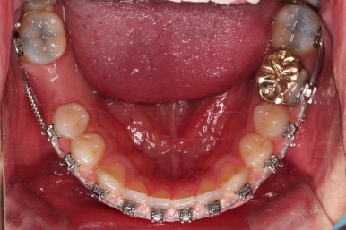 연산동임플란트