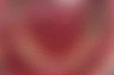 연산동임플란트